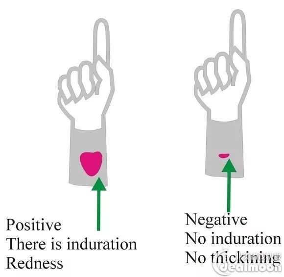 超详细!美国移民体检全攻略 这些注意事项 一定