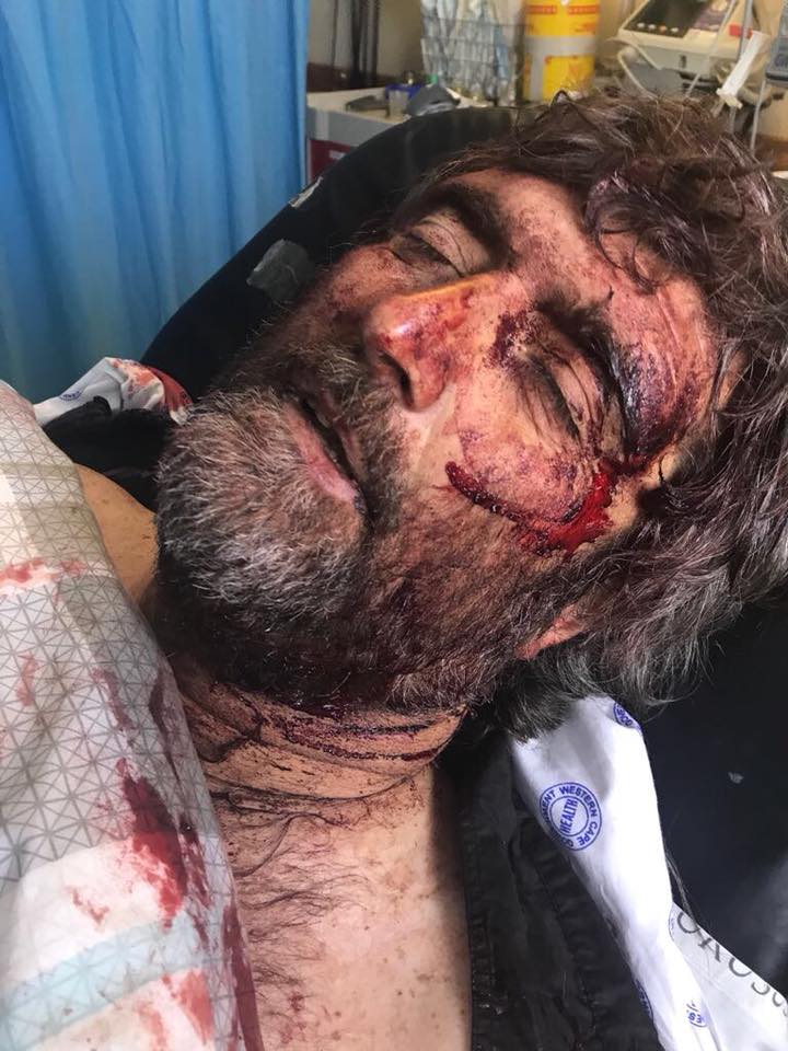 图片新闻:开普敦农场主遭塑料袋包头猛刺20刀