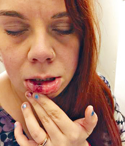 萨亚遇袭后嘴巴受伤.脸书图片