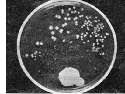 超级细菌在伊拉克战场肆虐 30年后或死上千万人
