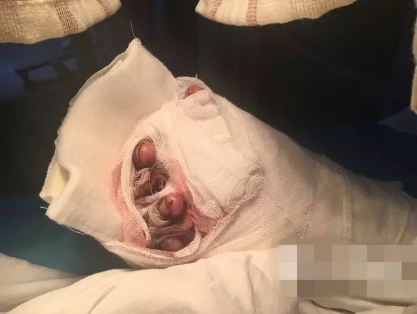 广西一熊孩子被炸飞,全因这个小动作!广西人过年千万警惕!