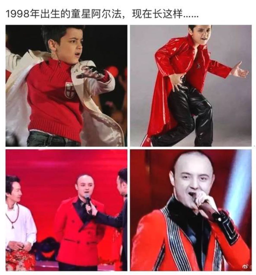 刚19岁的童星阿尔法长这样了?网友看崩溃:"秃"如其来