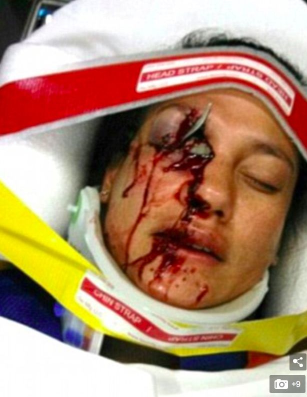 "高田气囊门"席卷澳洲,超三成的澳洲汽车面临安全隐