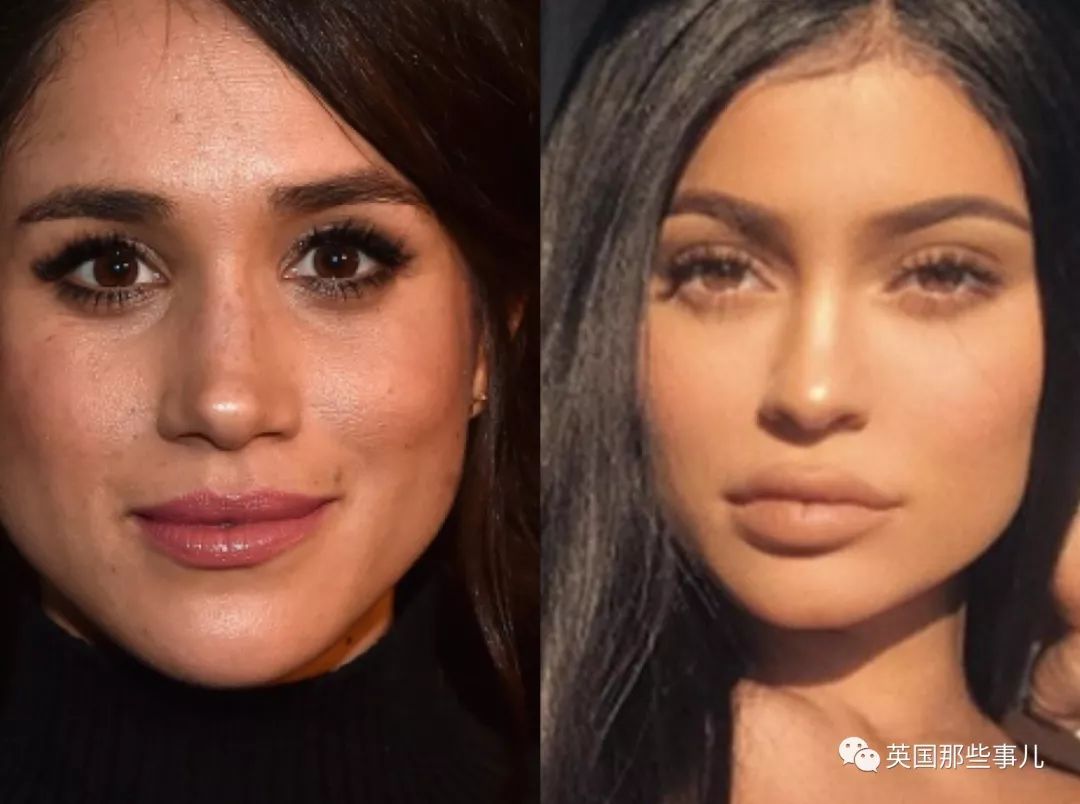 整容医师集体蒙圈了!欧美妹子又有新的追求(组图)