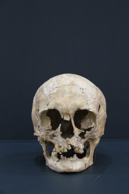 这位绳文女性的头骨