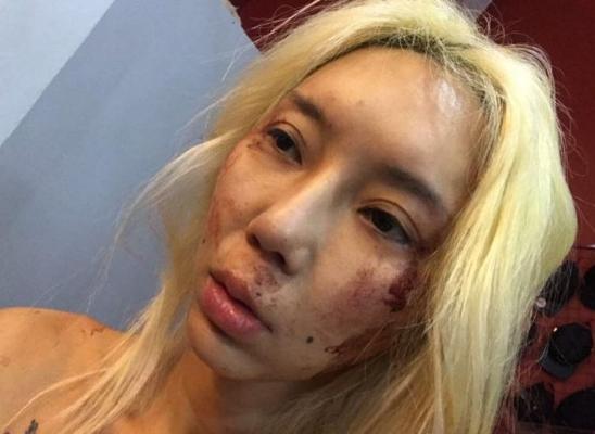 大马dj林云遭家暴 律师男友被捕后获释 【华人头条 - 马来西亚】