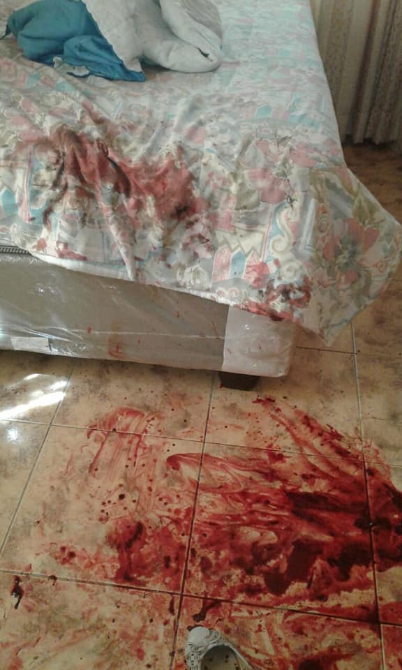 图文:家政工人刺伤雇主后逃逸 现场血迹斑斑