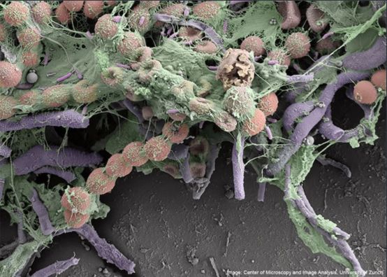 (小黄鸭内部的细菌显微镜图,图片来源:网络)另外,科学家还指出,越质量