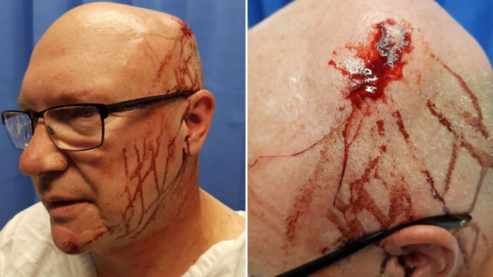 慎入| 悉尼发生群斗 一名警员劝架却被用玻璃瓶爆头