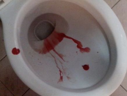 那些让你难以忍受的 第一劫:姨妈血滴在马桶上还不擦怪.