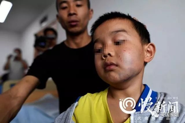 小孩用脚踢了我,所以我送他一个过肩摔(组图)